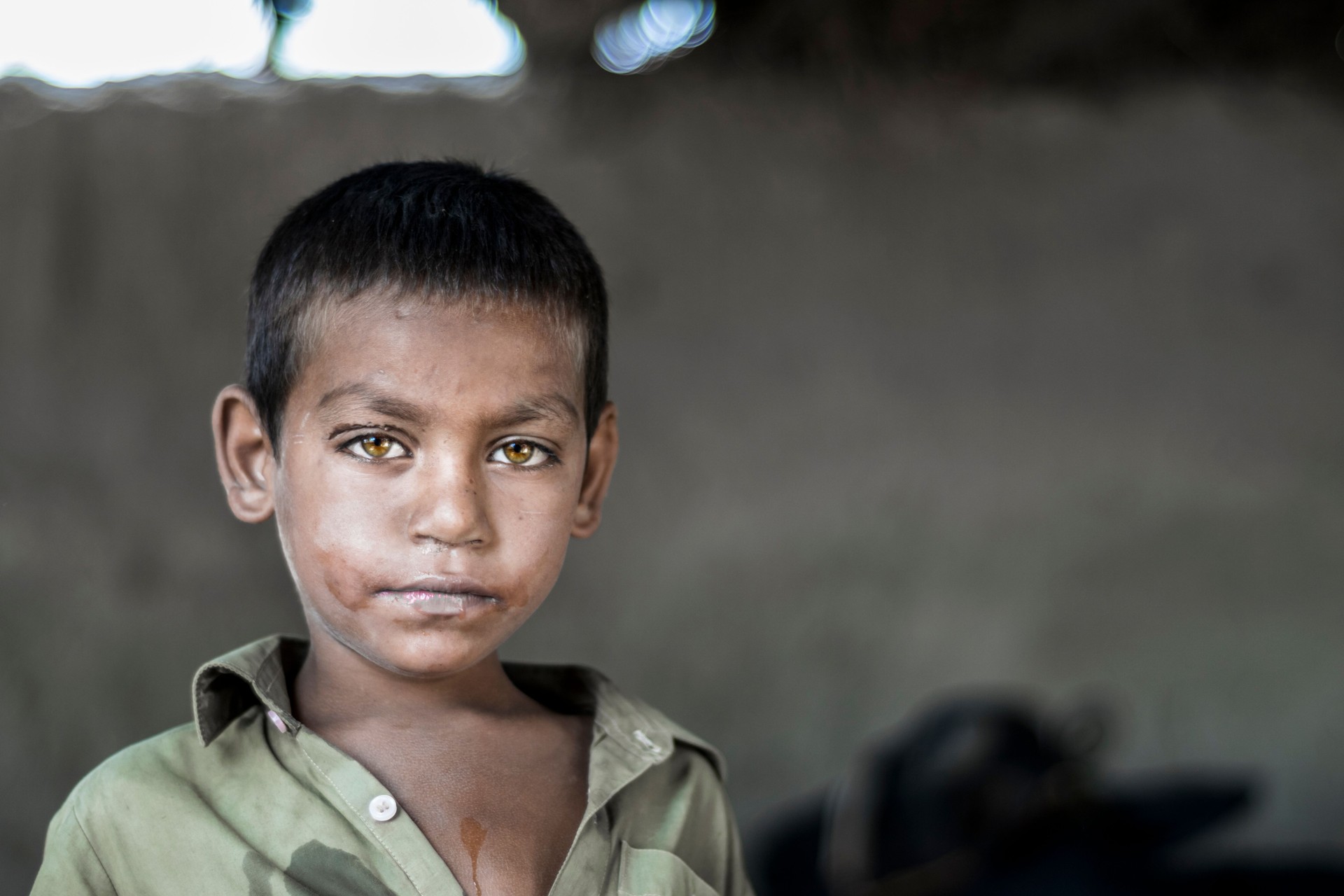 closeup of a poor staring hungry orphan boy in a refugee camp with sad expression on his face and his face and clothes are dirty and his eyes are full of pain